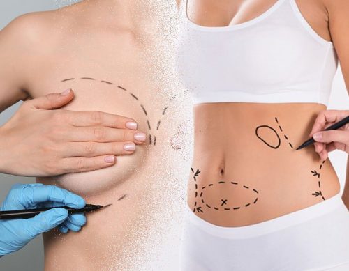 Masters Course in Liposuction and Breast Aesthetics (MCLBA)